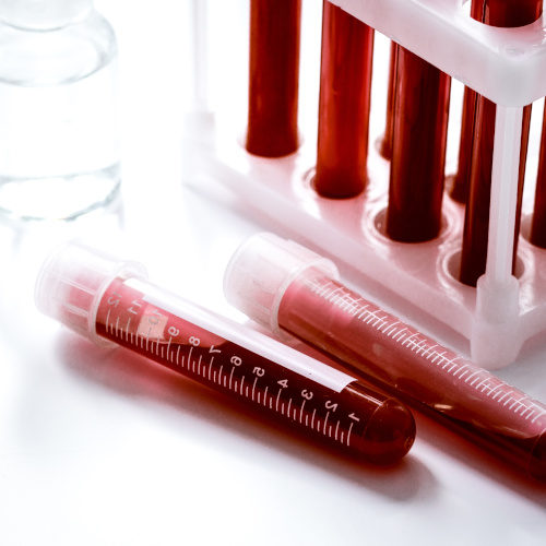 blood sample - Diagnostics-4-Future - Biolago